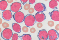 ������ϸ����Ѫ������������Щ����ҩ�