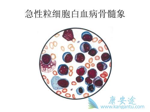 �������Ѫ��