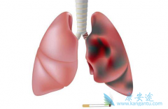 �����зΰ����ƿ����κ��𣿷ΰ�������Чҩ������