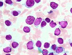 ������ϸ���԰�Ѫ����ʲô����Ѫ����������Щ��