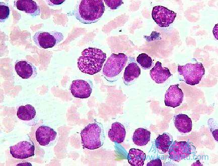 ������ϸ���԰�Ѫ��