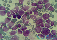 �ڲ�Ӱ���Ѫ������Ч�����������λ��⸱���ã�