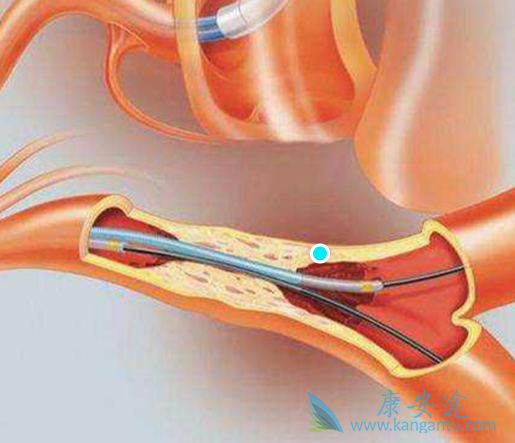 ��������;��������