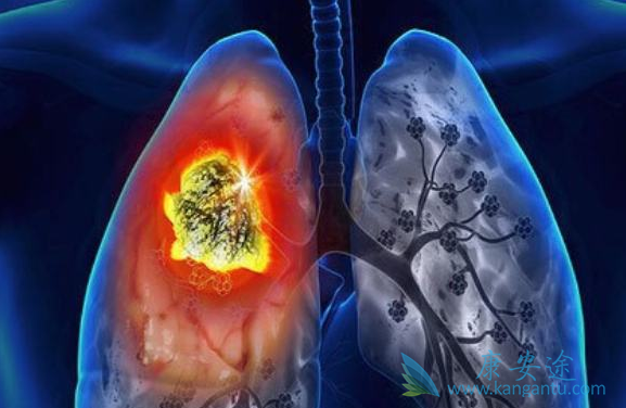 肺癌的治疗方式有哪些? 肺癌的治疗方式有哪些?