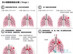 �ΰ�������ʱ���Ƕ��٣���Сϸ���ΰ������Ƶ�ҩ����