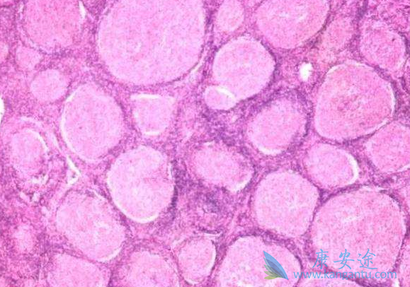 ������ܰ���