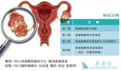 �ѳ�����֢״����Щ���Լ���������ʲô��˼��