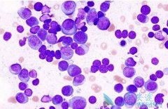 �෢�Թ�������ʲô���෢�Թ�������Ӱ�쵽��ϵͳ��