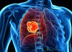 �ΰ�egfr�е�ͷΰ�EGFRҩ��Ч������