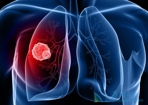 �ΰ�������ô����