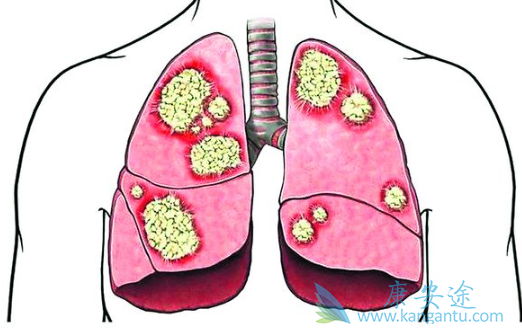 �ΰ�������ô����