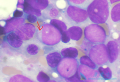 ������ϸ����Ѫ���ܻ��ã����ȷ�