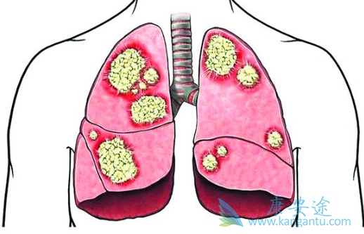 �ΰ�����е�