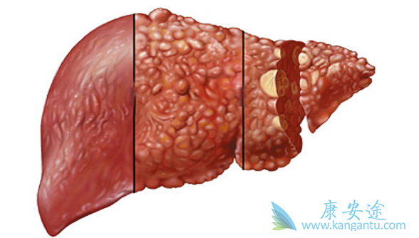 乐伐替尼;多吉美 乐伐替尼;多吉美