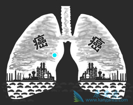 肿瘤;癌症转移 肿瘤;癌症转移