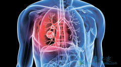 �ΰ�����֢״����Щ����ôԤ����֢��