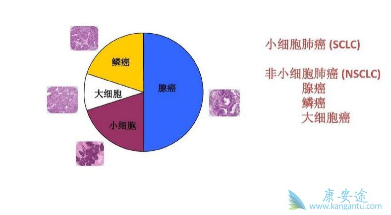 ��Сϸ���ΰ�