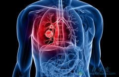 �ΰ�egfr�е�ͻ�����Ի�������PD1������