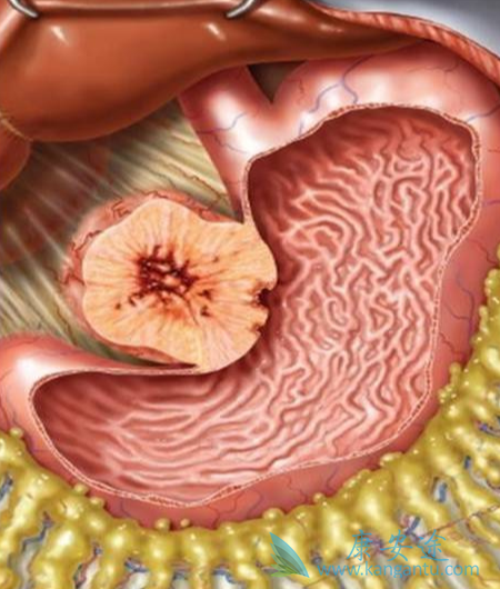 θ��������;��������