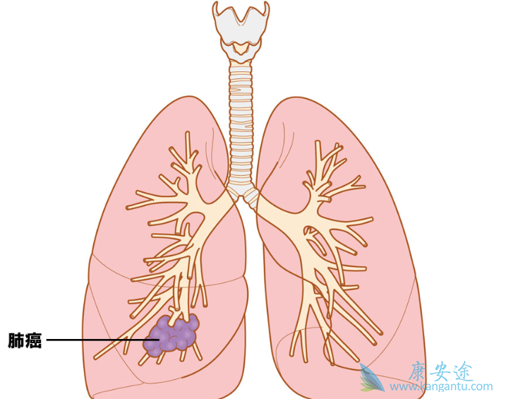 ���ٰ�;�ΰ�������