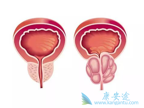 ǰ���ٰ�;����ǰ���ٰ�