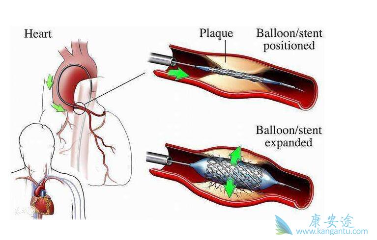 ����֧����Ҫע��ʲô