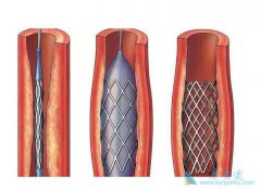 ����֧������ôʹ�õģ�ʹ�ù���֧�ܵ�ʱ�䳤��