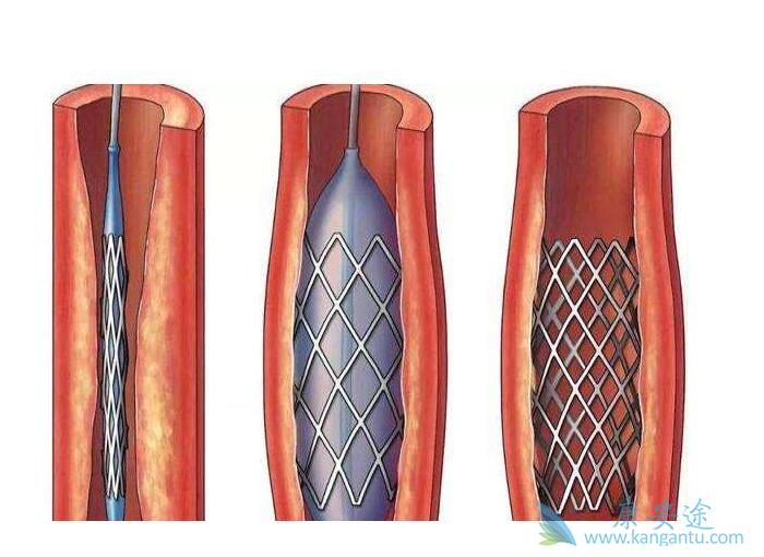 ����֧��