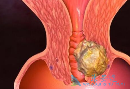 �ѳ���;����