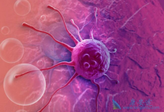 ��δӳ����������ҵ���������֢״��