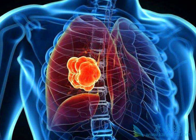 肺癌基因靶点 肺癌基因靶点