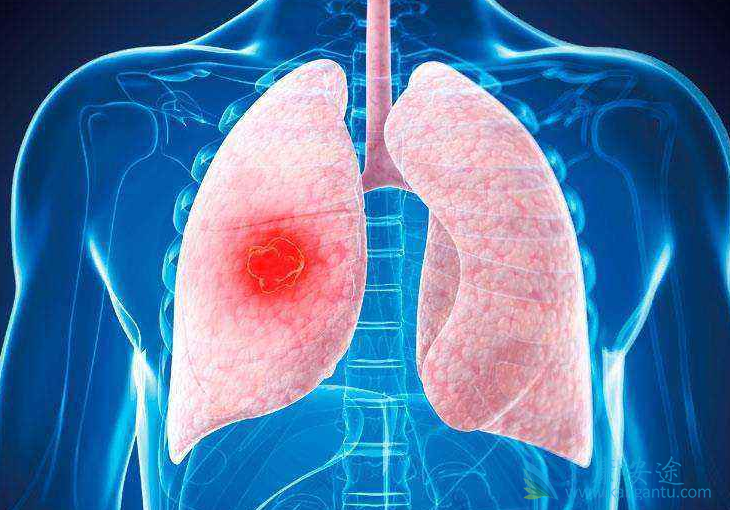 �ΰ�;��������