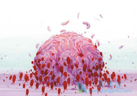 肿瘤转移;乳腺癌 肿瘤转移;乳腺癌