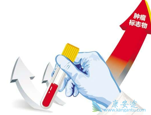 肿瘤标志物;肿瘤 肿瘤标志物;肿瘤