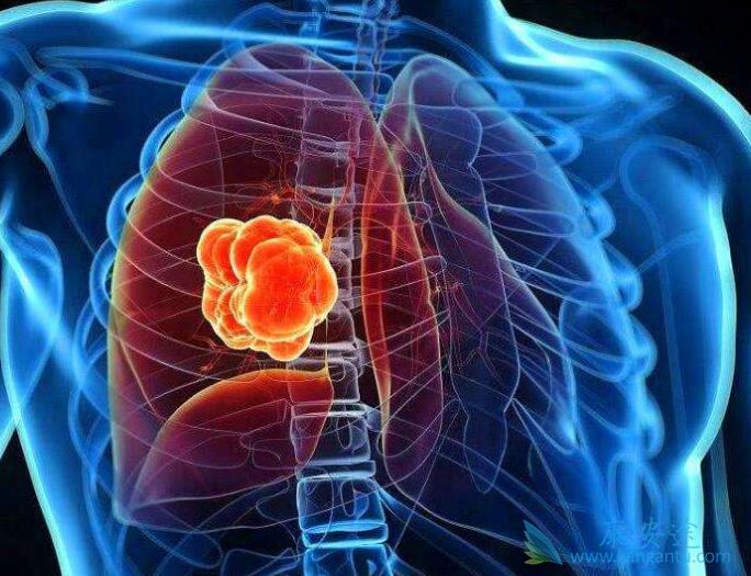 �ΰ����ڱ���