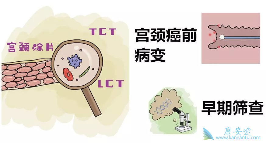 宫颈癌的治愈率;宫颈癌 宫颈癌的治愈率;宫颈癌