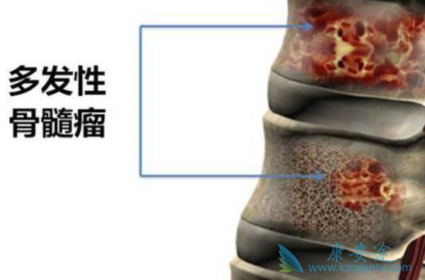 �������ܻ���