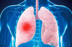 Ů��Ϊ��Ҳ��÷ΰ���һ��֢������������ʷ�ĸ����׻�����