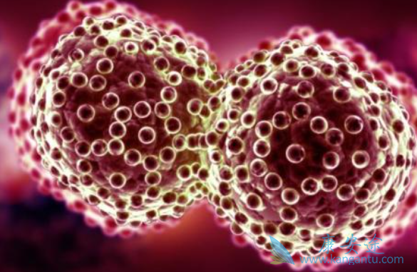 奥拉帕利 奥拉帕利