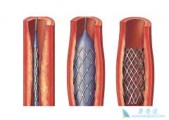 ����֧�ܶ��ڼ����ļ�������Ч����