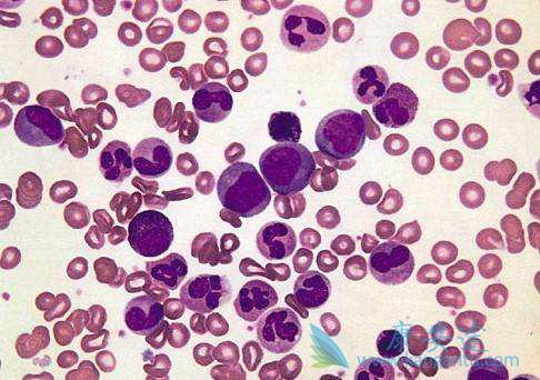 ���԰�Ѫ��