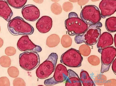 ���������������ܰ�ϸ����Ѫ���������ƵĻ���