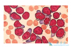 ������ϸ����Ѫ���ͼ��Թ����԰�Ѫ����ͬ���ͼ�����