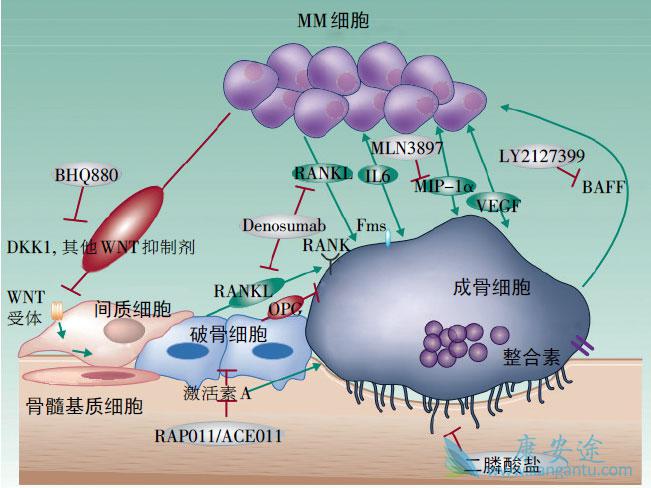 多发性骨髓瘤临床表现 多发性骨髓瘤临床表现