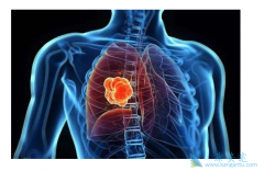 ���޿���һ�߷ΰ�����ҩ�� ��ô���޿���ҩ�ı�������Щ