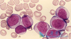 ���ư�Ѫ������Щ�ֶΣ�