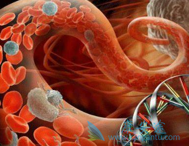 前列腺癌 前列腺癌