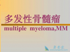 BCL2���Ƽ��ǹ����������бȽ����ŵİ���ҩ��