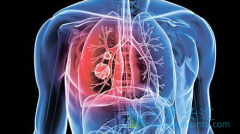 �ΰ���һ�ֶ������������Ʒΰ���ҩ�����