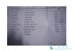 乙肝表面抗体阳性可以检测出乙肝病毒吗？